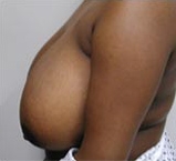 Pre-op