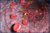 Illustration of clot formation in blood vessels
