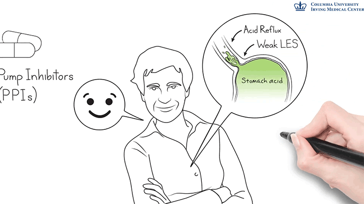 Video Thumbnail: Understanding GERD